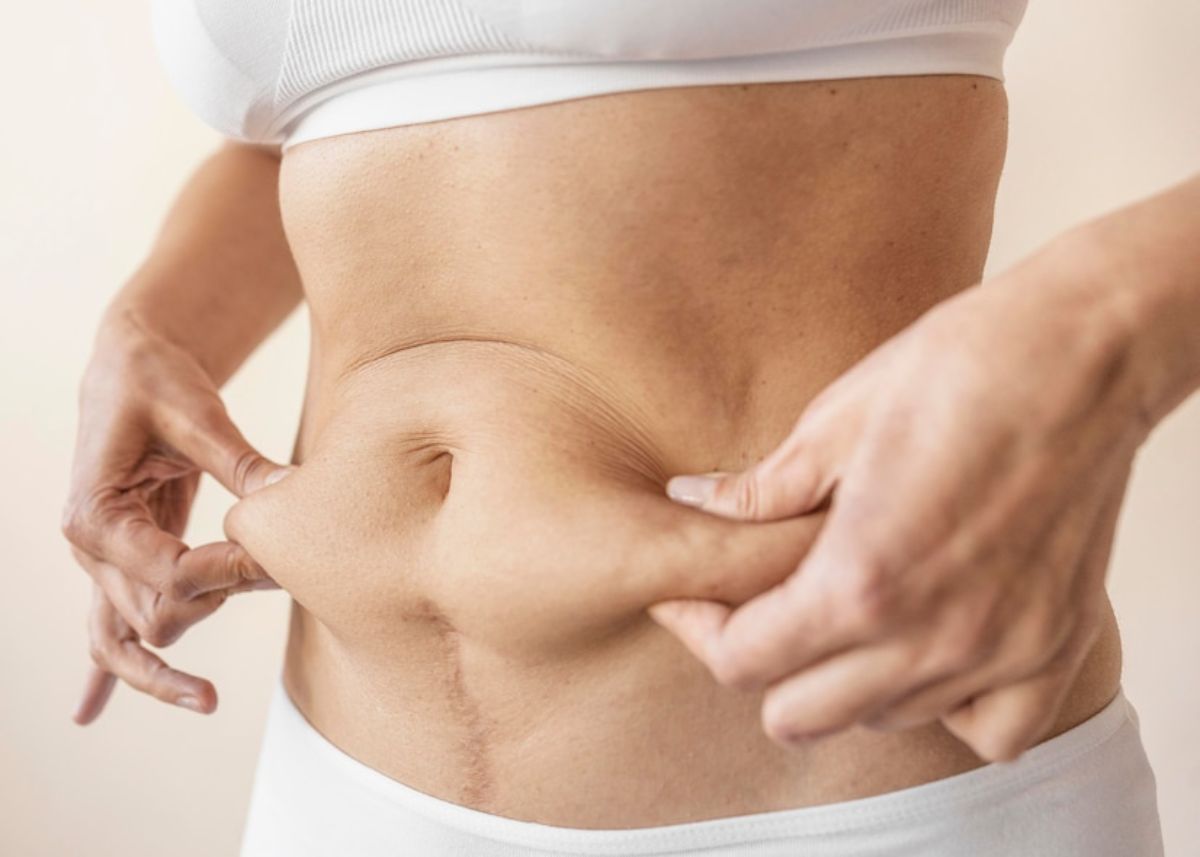 Coolsculpting